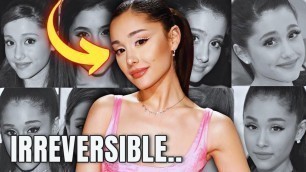'What \"HAPPENED\" to Ariana Grande\'s EYES? - Plastic Surgery Analysis'