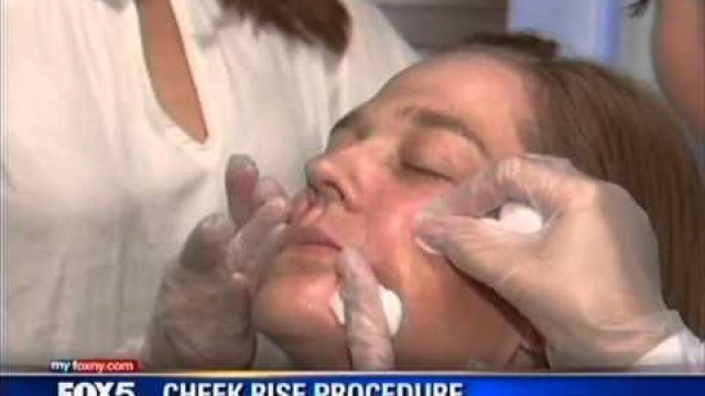 'CheekRise by Dr. Stephen Bracci of Verve Medical Cosmetics on Fox5 News'