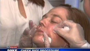 'CheekRise by Dr. Stephen Bracci of Verve Medical Cosmetics on Fox5 News'