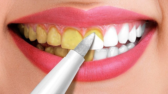 '30 Amazing Hacks For A White Smile || Beauty Tricks and Tips'