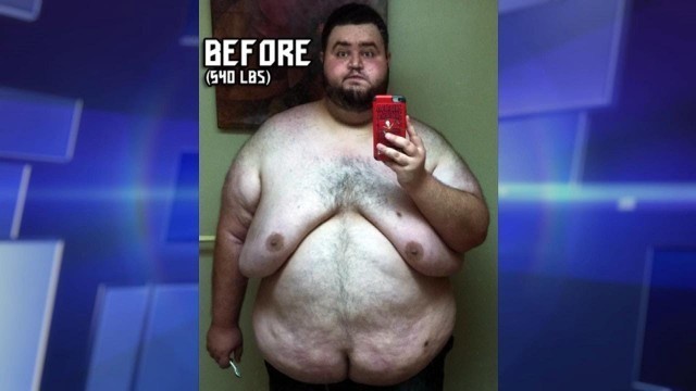 'Man’s Incredible Weight Loss and Overcoming Food Addiction'